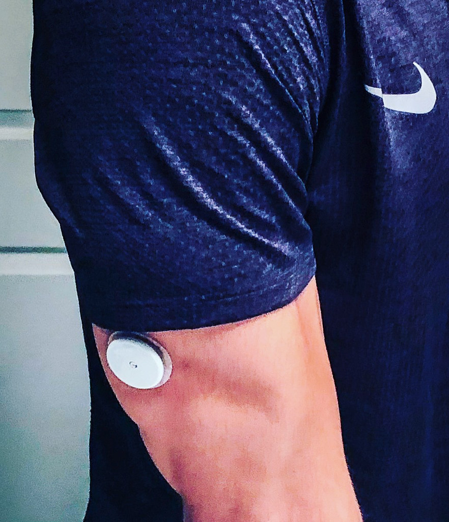 Continuous Glucose Monitors Explained