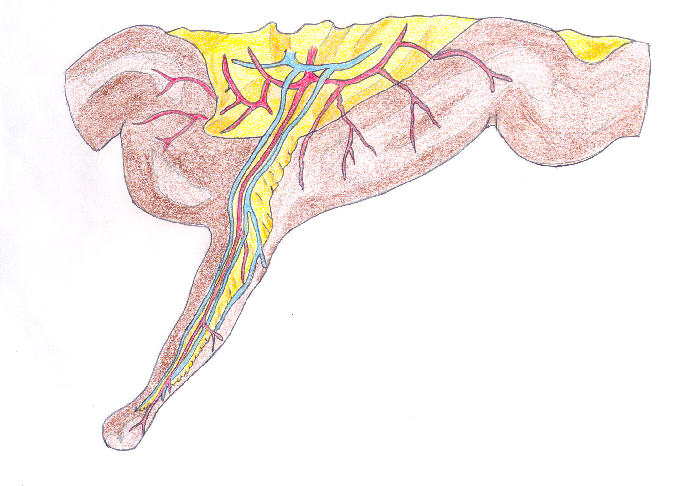 Diverticulosis Versus Diverticulitis