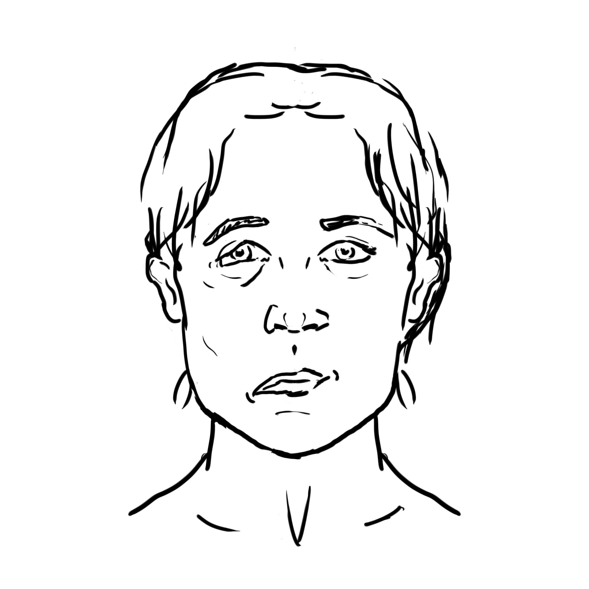 Know the Warning Signs of a Stroke